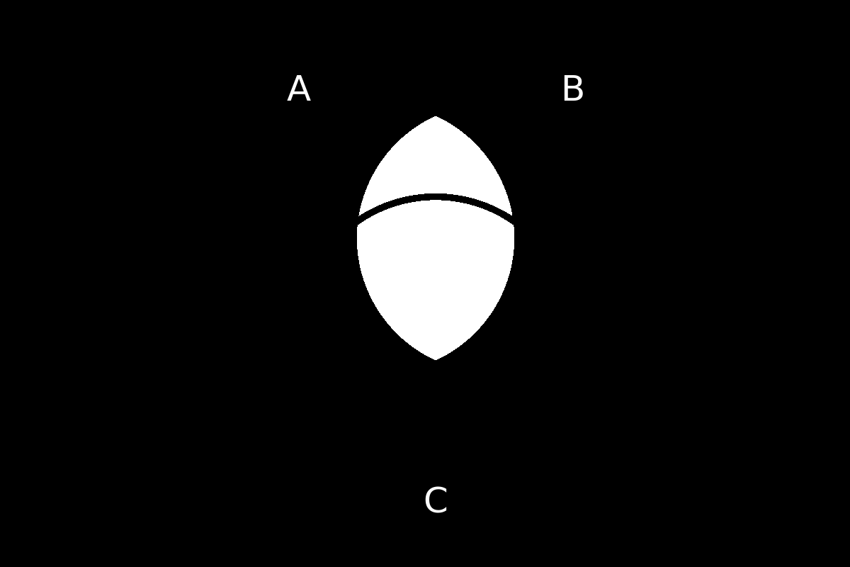 venn diagram 252
